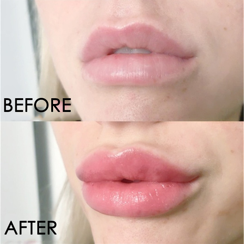 Sérum de soin pour les lèvres, - Lip Gloss Plumping avis et prix